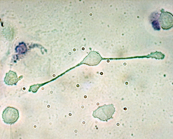 What are macrophages — photograph