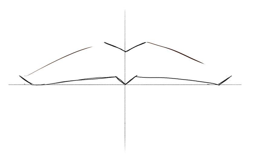 A photo showing the finished outline of the upper lip.​