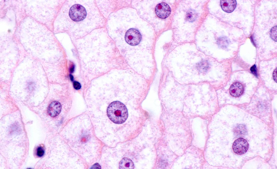 What is the difference between nucleus and nucleolus? The image depicts the nucleolus as a part of the nucleus.