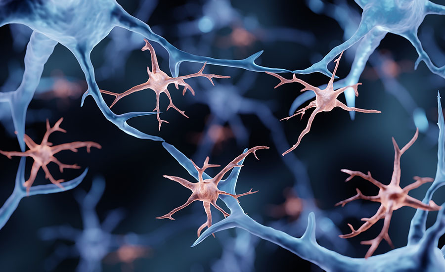 A stock image depicting microglia.​