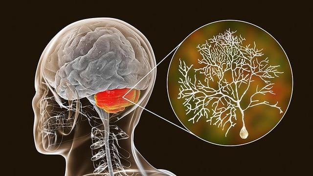 Stock image showing a Purkinje neuron.​